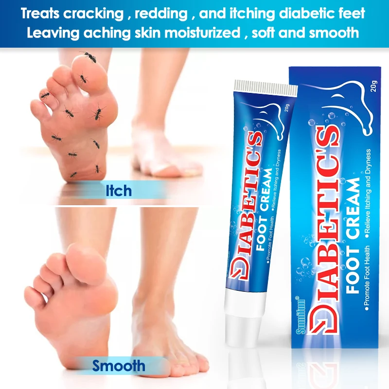 Sumifun Diabetes Ulcer Foot Treatment Cream Anti Inflammation Debaucjed Diabetic Ulceration Itch Relief Skin Repair Ointment 20g