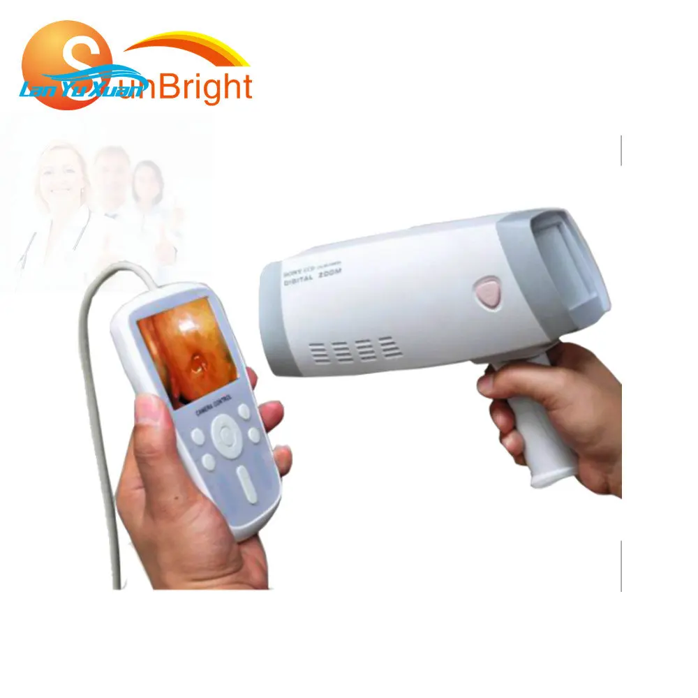 Handheld all Digital Medical Video Colposcope machine Electronic Portable Colposcopy For Gynecology