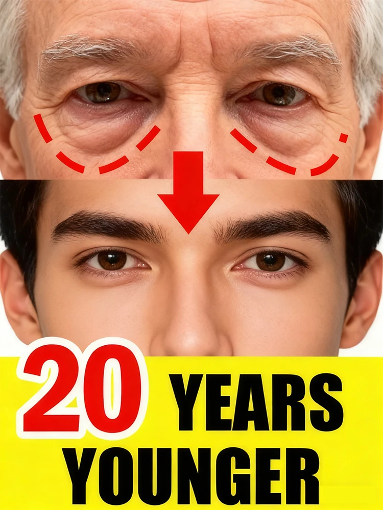 

2nd ᵍᵉⁿᵉʳᵃᵗⁱᵒⁿ ᵘᵖᵍʳᵃᵈᵉᵈ eʸᵉ ⸴ ʳᵉpᵃⁱʳ eʸᵉˢ ʳᵒoᵗ ⸴ ᑫᵘⁱᶜᵏˡʸ