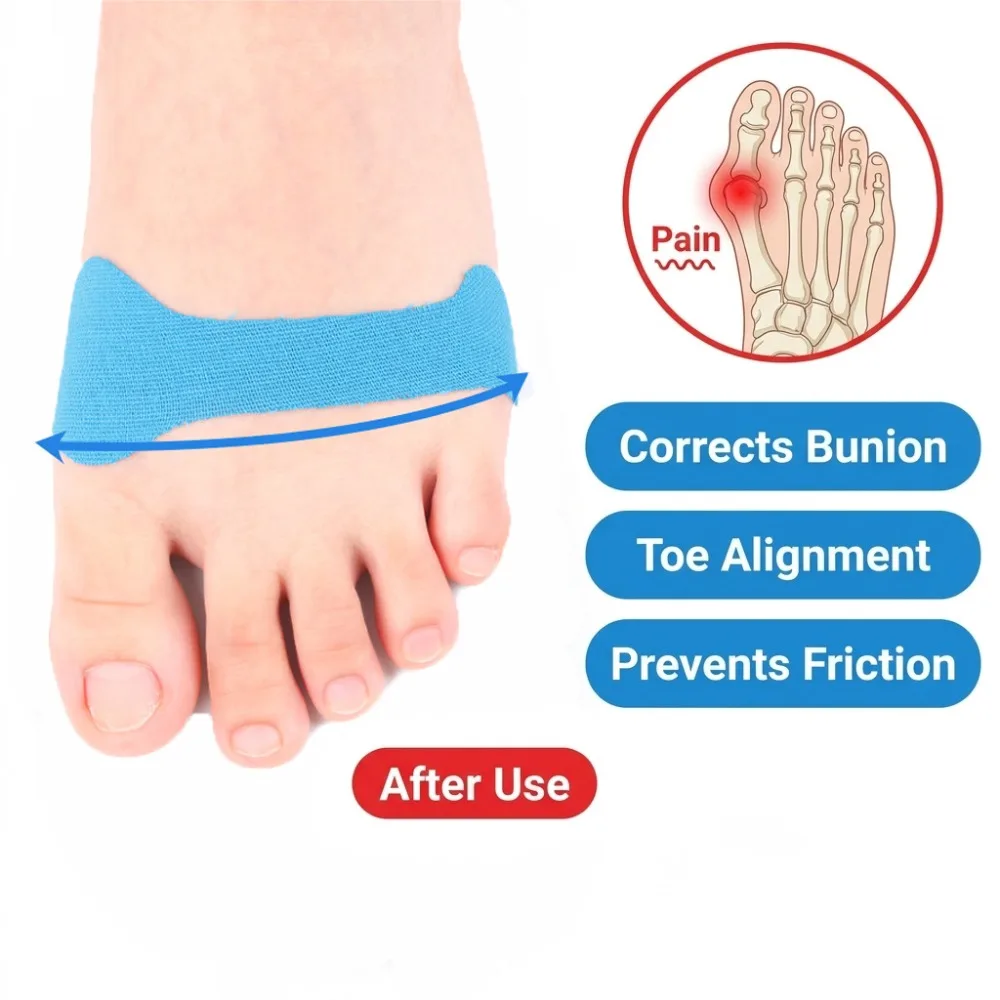 5/10/20Pcs Precut Elastic Kinesiology Tape for Thumb Fingers Pain Relief & Support Toe Hallux Valgus Correction Protector Sports
