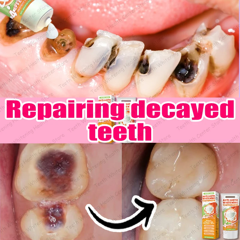 

99% of people repurchase, repairs tooth decay and cleans teeth, hot sale