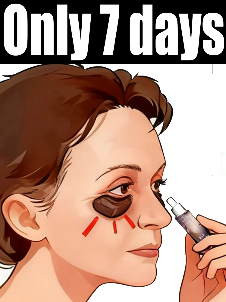 Fᴀsᴛ-Rᴇsᴜʟᴛs Eʏᴇ Cʀᴇᴀᴍ - Fᴀᴅᴇ Sʜᴀᴅᴏᴡs & Sᴏᴏᴛʜᴇ Pᴜғғɪɴᴇss, 2025 Tᴏᴘ Pɪᴄᴋ