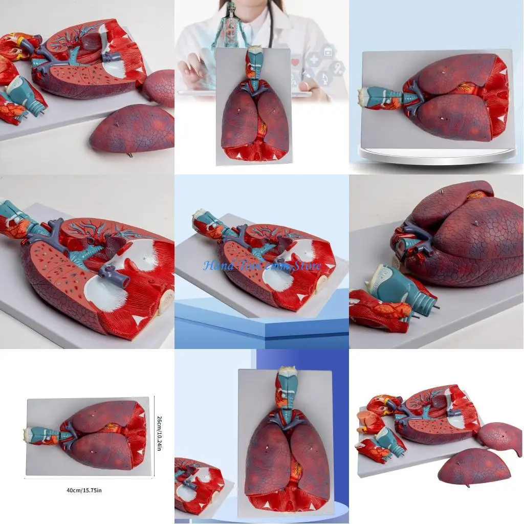 

H37F Anatomical Lung Model Shows Detail of Respiratory System, Lung Anatomy Model