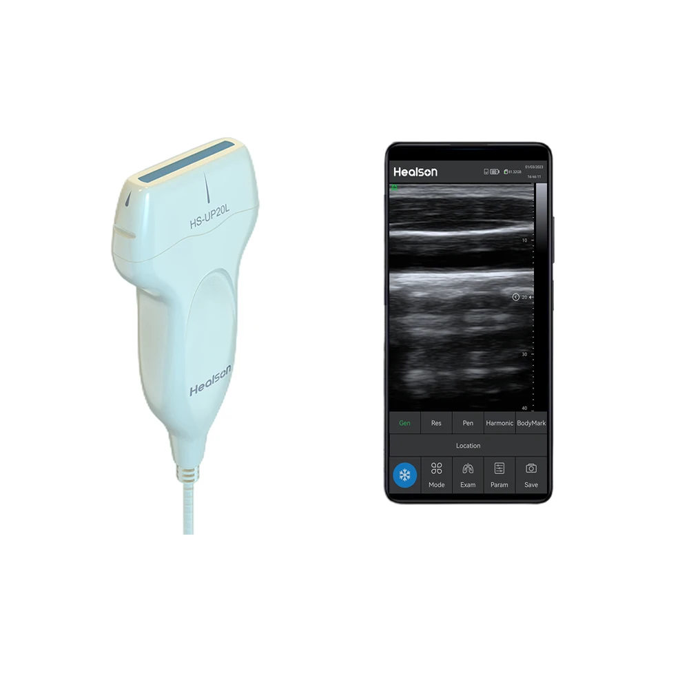 Healson B mode linear Digital ultrasound diagnostic system portable ultrasound scanner device with Android smartphone for  MSK