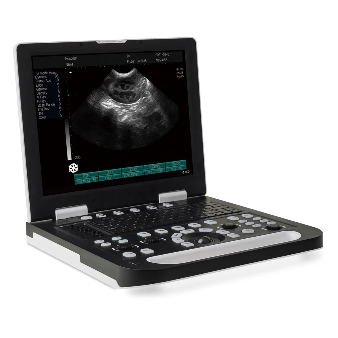 Animal Use 15 Inches LED Laptop Ultrasound Scanner Pregnancy Notebook Machine for Dog Cat Pig Cattle Sheep Veterinary Instrument