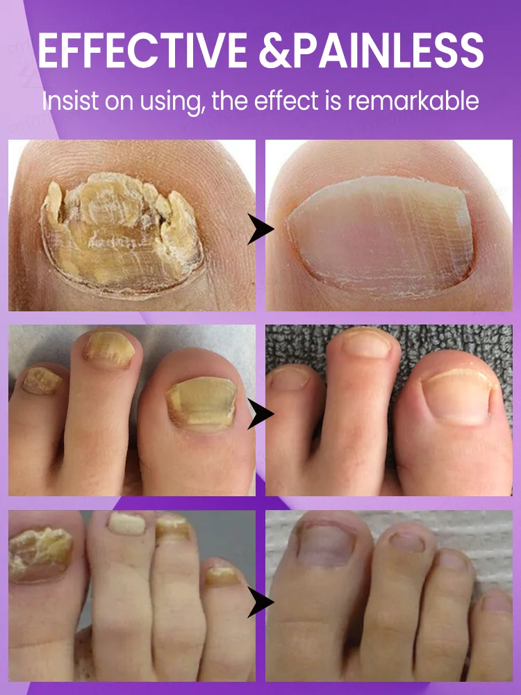 ᴿᵉᵐᵒᶜ̧ᵃ̃ᵒ ᵖʳᵒᶠⁱˢˢⁱᵒⁿᵃˡ ᵈᵒ ᶠᵘⁿᵍᵒ ᵈᵒ ᵖʳᵉᵍᵒ