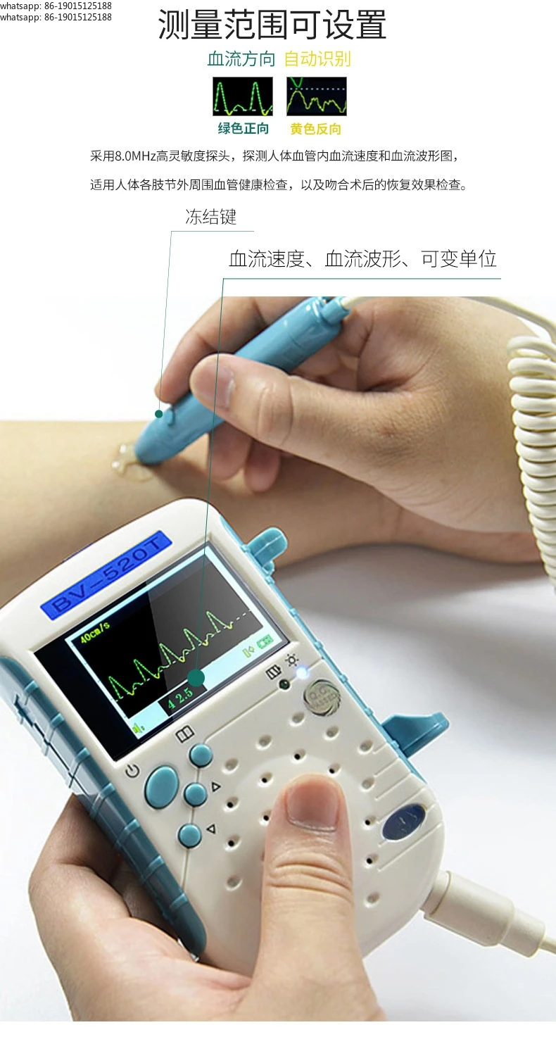 Vascular Blood Flow Meter Velocity Detection Observation Medical Ultrasound Blood Detection Arteriovenous