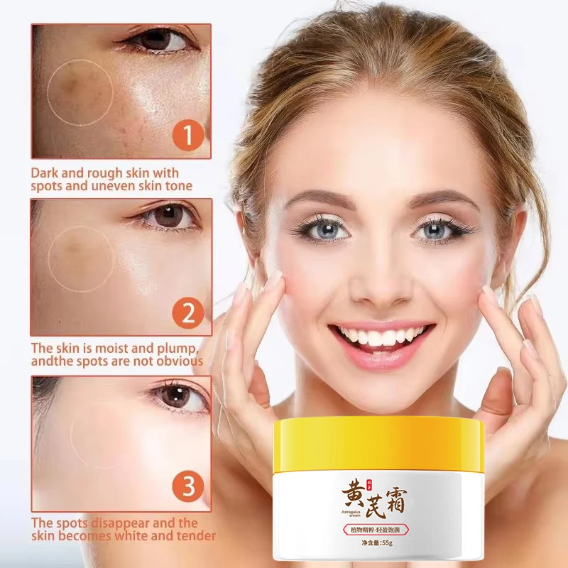 Astragalus Facial Whitening Moisturizer,Freckle Removal Cream, Face Dark Spots Melasma Melanin Remover,Skin Brighten Repair Care