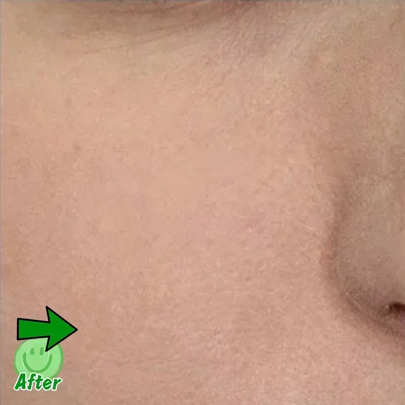 Pore Shrinking Serum Face Removing Large Pores Tightening Repairing Facial Pore Minimizing Essence Skin Care Beauty