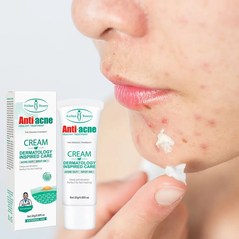 

Effective Acne Removal Cream Herbal Acne Spots Oil Control Acne Cream Skin Care Whitening Moisturizing Face Gel Skin Care 20g