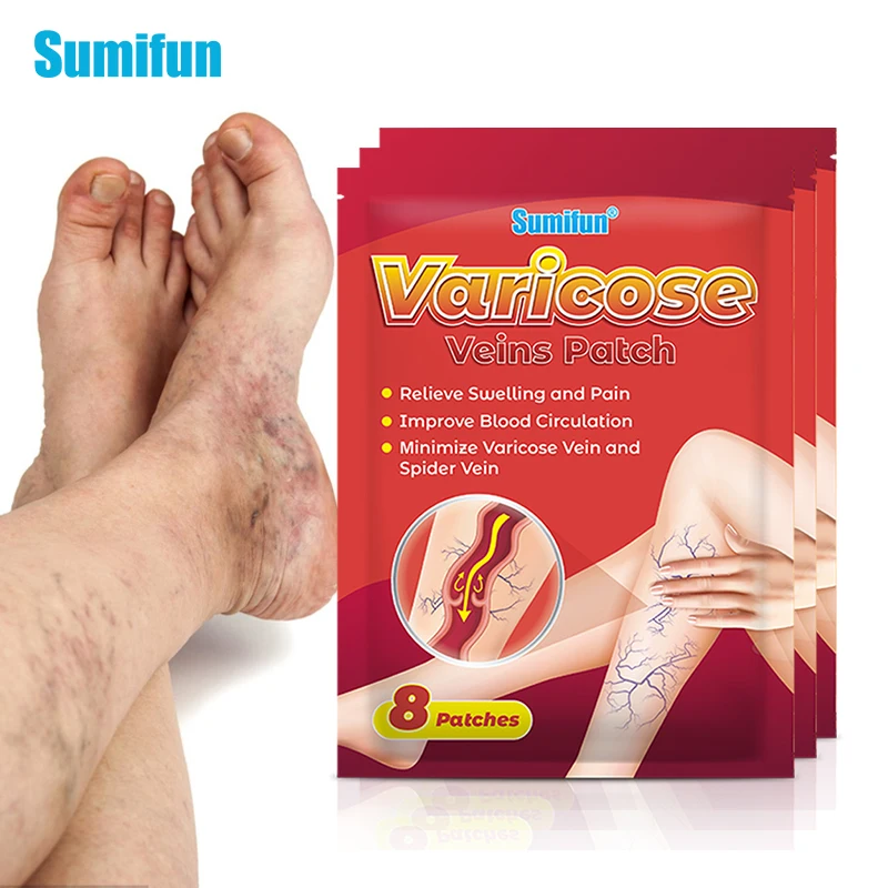 

8/24/48pcs Sumifun Varicose Veins Patches Vasculitis Phlebitis Spider Sticker Varicosity Angiitis Removal Herbal Medical Plaster