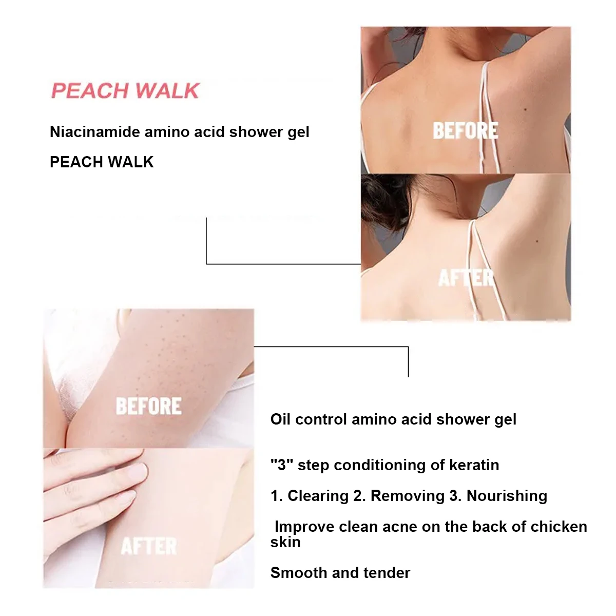 WHITE PEACH WALK Deep Steep BODYWASH Removed Chicken Skin, Acne, Anti Blemish Whitening Moisturizing Soft And Smooth