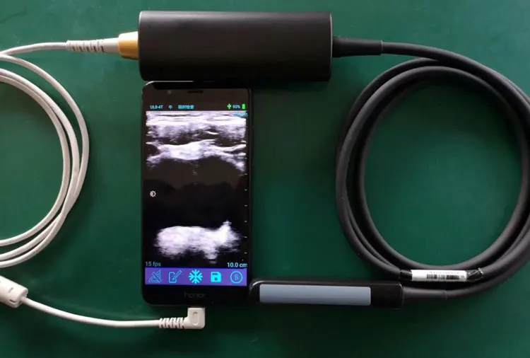 MY-A010A-E portable mini USB ultrasound Veterinary Vet Rectal Linear USB probe ultrasound for animal use