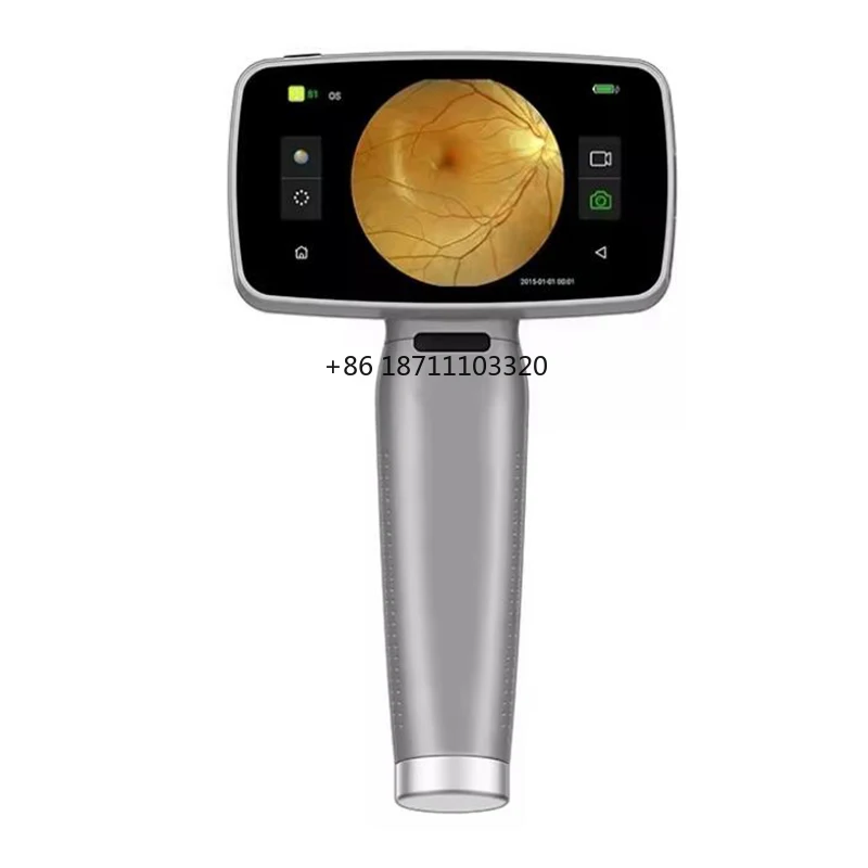 Ysenmed YSENT-HFC1 Ophthalmology Handheld Retinal Camera Test Digital Portable Eye Fundus Camera Digital Eye Fundus Camera