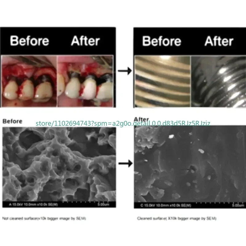 Debridation Peri-Implantitis Implant Powierzchnia Implantów Szczotka tytanowa do odbudowy implantów Konserwacja pochylenia Narzędzia dentystyczne