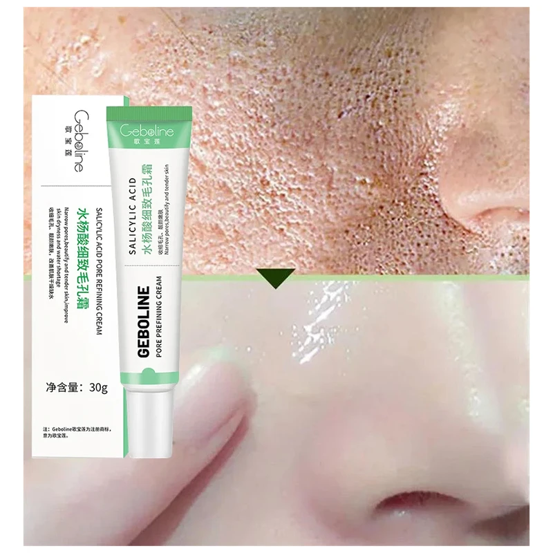 Salicylic Acid Pore Shrinking Cream Quick Elimination Large Pores Remove Blackehead Tighten Face Smooth Skin Care Korean Product