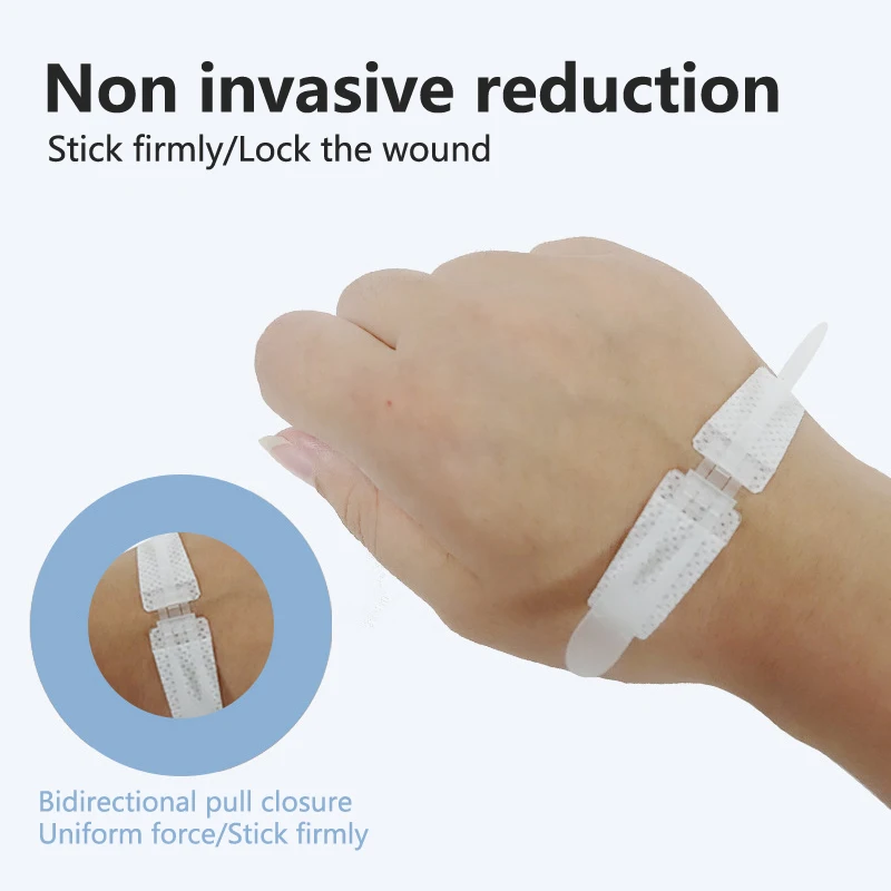 *Zipper Band-aid Painless Wound Closure Device Suture-free Wound Dressing Patches Zip Suture Reducer Band Aid Outdoor Portable