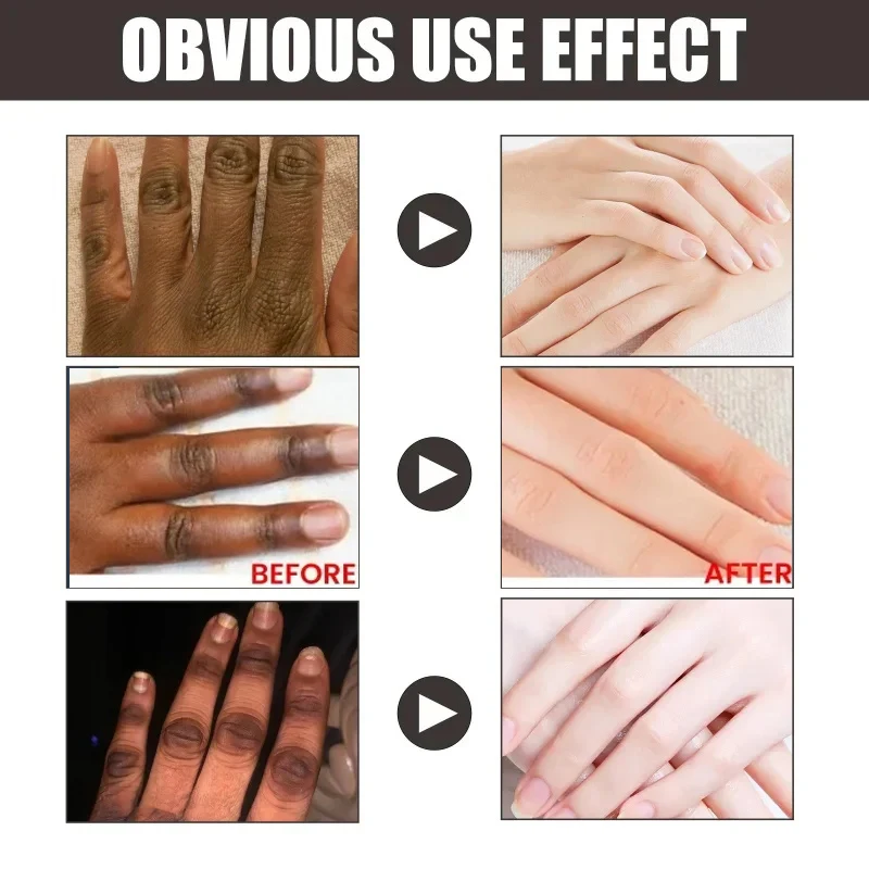 Dark Knuckles Fast Whitening Serum Anti Cracking Cream Pigmentation Correctors For Black Skin Intense Stains Remover Products