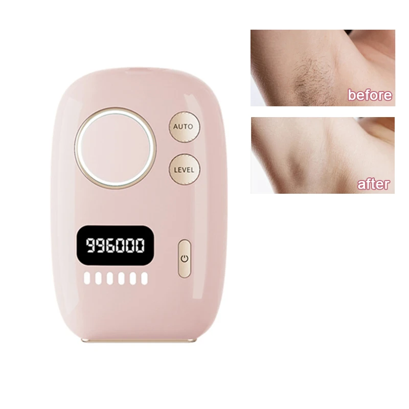 آلة إزالة الشعر الذكية ومضات إزالة شعر الوجه والجسم آلة إزالة الشعر الدائمة للرجال والنساء تستخدم آلة منزلية محمولة #1
