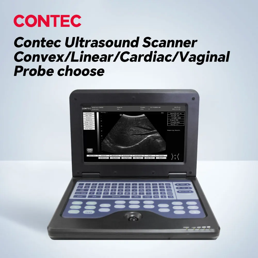 CONTEC Digital Portable Laptop Ultrasound Scanner Machine Convex/linear/cardiac/Transvaginal probe  Clinic or Hospital Use