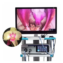 Medical 4K  Endoscopys Camera System for Laparoscopys/Urologys/Hepatobiliarys Surgery/Orthopedicss/Otolaryngologys/Neurosurgerys