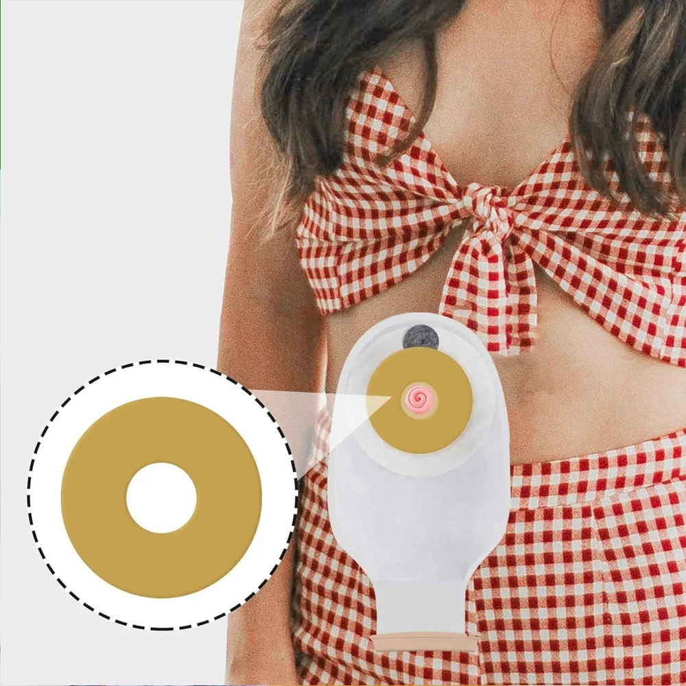 

20 Pieces Colostomy Bags Anti-leak Ring Portable For Stoma Bags Supplies Protective Barrier Rings Ostomy Bag Assistance