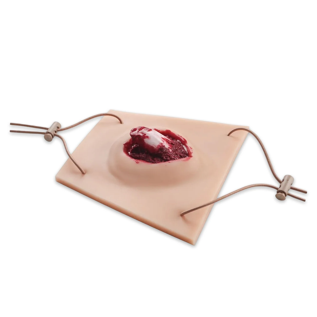 Wearable Open Fracture Task Trainer, Silicone Compound Fracture Wound Model