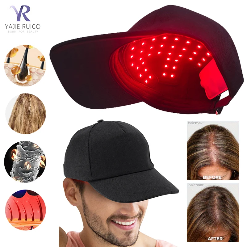 

Infrared Phototherapy Anti Hair Loss Laser Treatment Hat Helmet Hair Growth Regeneration Phototherapy Equipment Machine