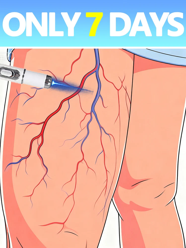 ترقية جديدة لعام 2026 قلم الضوء الأزرق يحل في 7 أيام أداة الوريد رائجة البيع #1