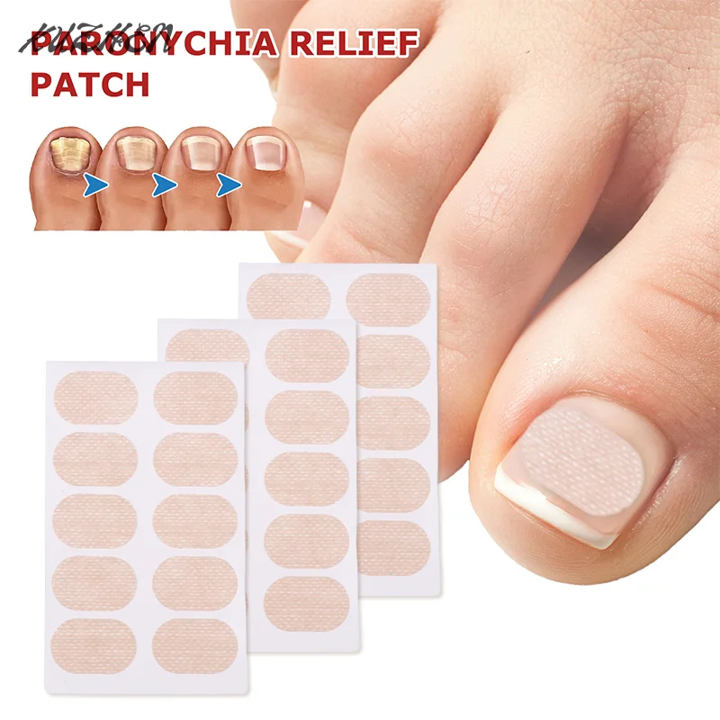 

10pcs Nail Correction Stickers Ingrown Toenail Onychomycosis Repair Patch Paronychia Treatment Recover Corrector Pedicure Tools