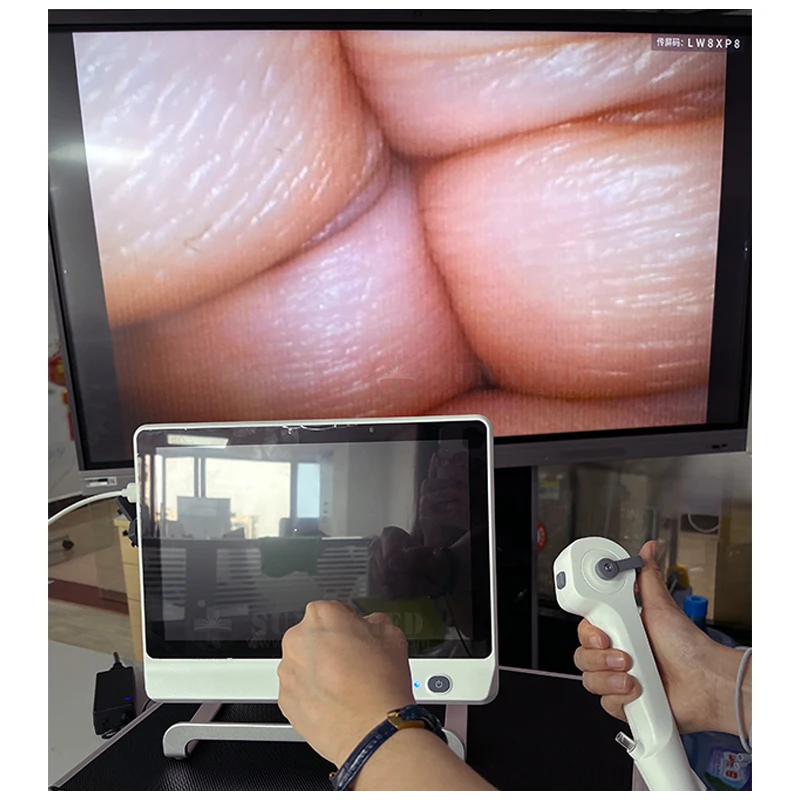 P029-3 Animal Endoscope PET Bronchoscope Gastroscope Colonoscope Ureteroscope Veterinary Endoscope Horse