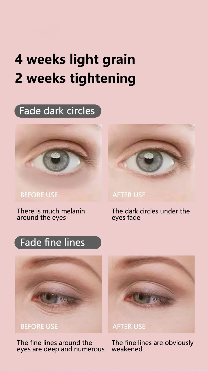 EMS Microcurrent Facial Lifter - อุปกรณ์บําบัดด้วยแสงสีแดงและต่อต้านริ้วรอยสําหรับการนวดคอตา กระชับผิว