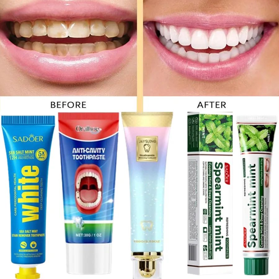 Ginger Mint Flavored Toothpaste Multi-effect Gum Care Toothpaste To Clean Tartar and Fix Teeth Teeth Sensitivity Relief &Cavity