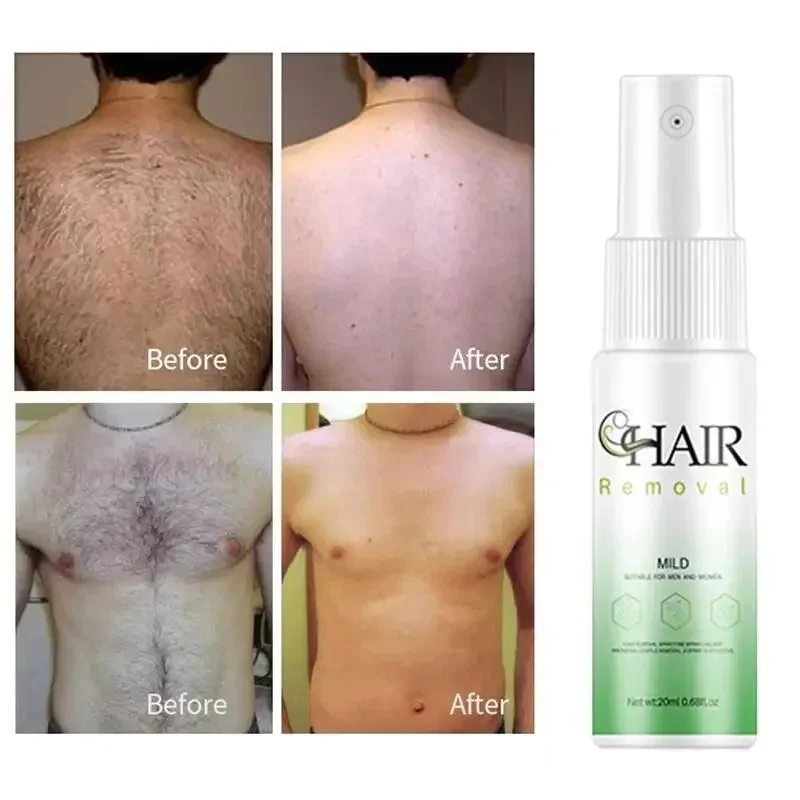 Pulverizador indolor da remoção do cabelo para homens e mulheres, Depilatory permanente, inibidor do crescimento do cabelo, braço, axila, pé, cara,