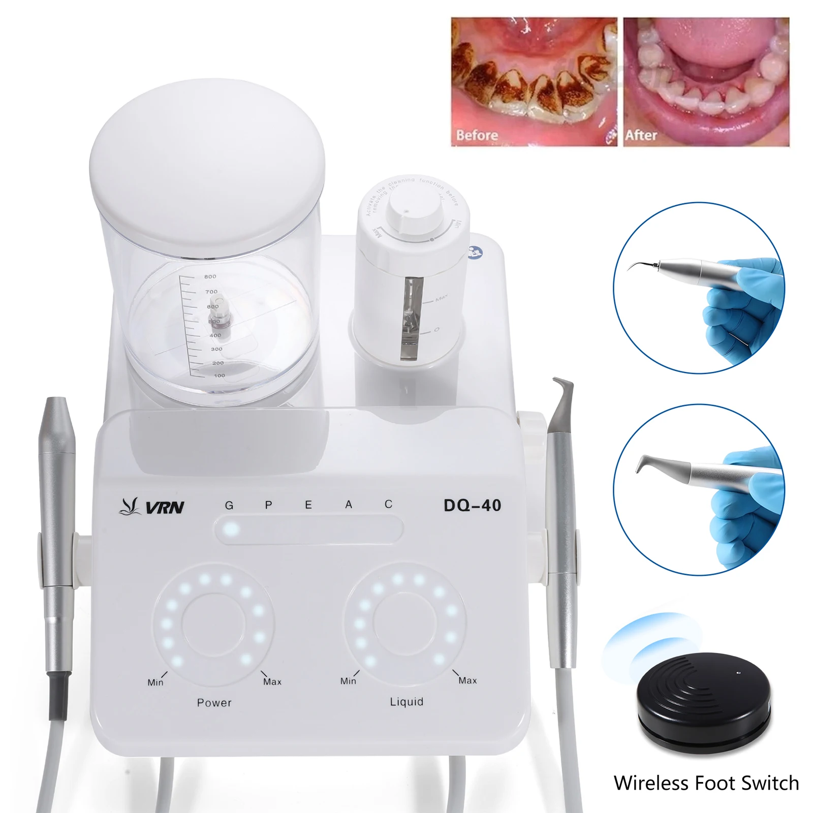 5 IN 1 Dental Ultrasonic Scaler Sandblasting Periodontal Therapy Integrated Machine