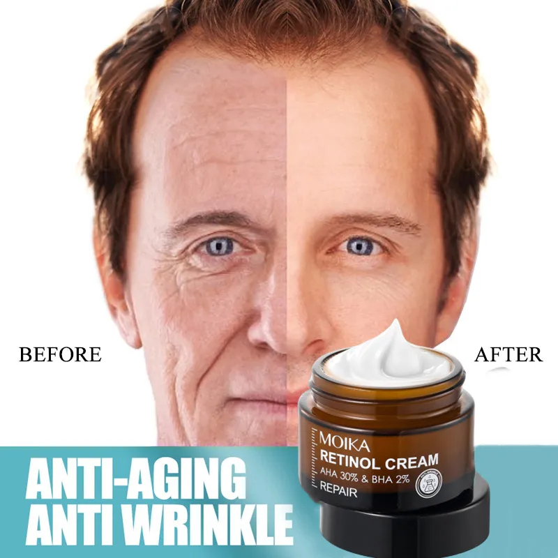 Men Anti-aging Wrinkle Face Cream Retinol Cream for Men Firming Moisturizing Retinol Face Cream Anti-aging Facial Treatment 30g