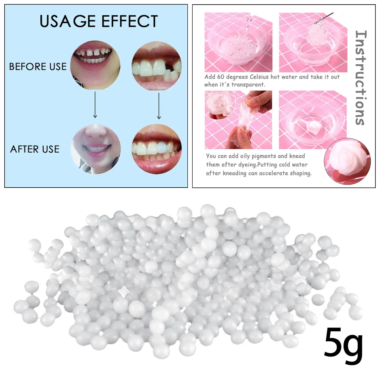 Temporary Tooth Repair Kit Restoration of Missing and Broken Veneers