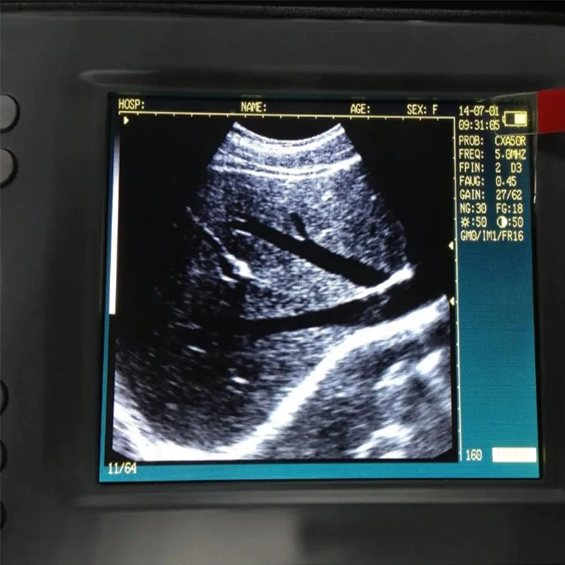 Handheld Veterinary Ultrasound Machine Portable Vet Ultrasound for Animal   Clinic Ultrasound Machine