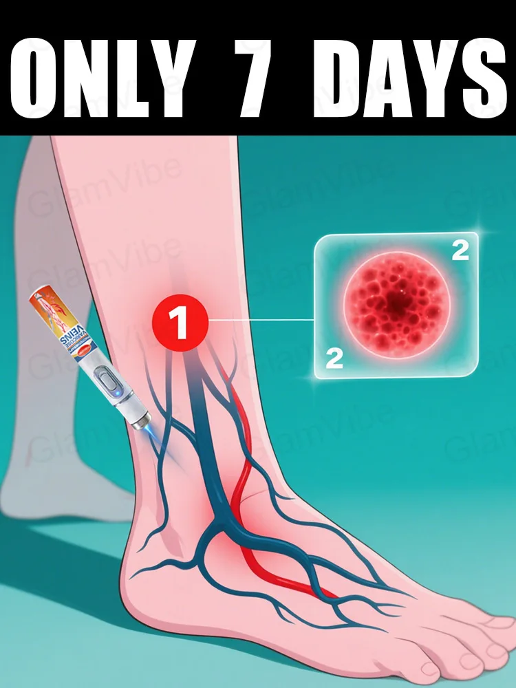 

Generation-2 Laser Says Goodbye To Spider Legs Varicose In 7 Days