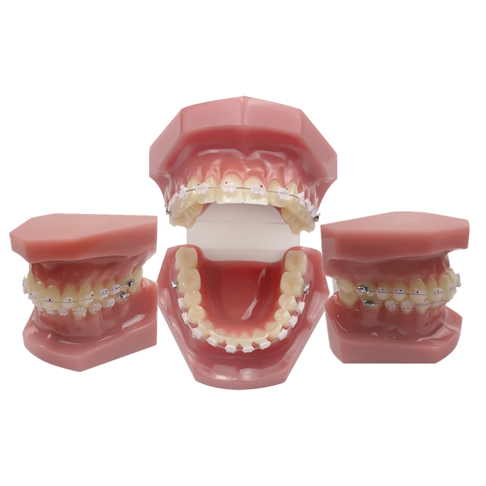 

Dental Orthodontic Teeth Model With All Ceramic Bracket Ortho Tooth Model For Study Education Dentist-Patient Communication Demo
