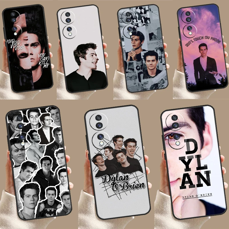 Teen Wolf Dylan O'Brien Case For Honor Magic 6 Pro 5 Lite 50 70 90 Lite X7 X8 X9 X6a X7a X8a X9a X8b X9b Back Cover