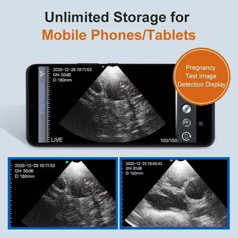 Portable Veterinary Ultrasound Scanner Wireless for Pigs Dogs Sheep IP67 Probe Handheld Ultrasound Scanner Pregnancy Detection