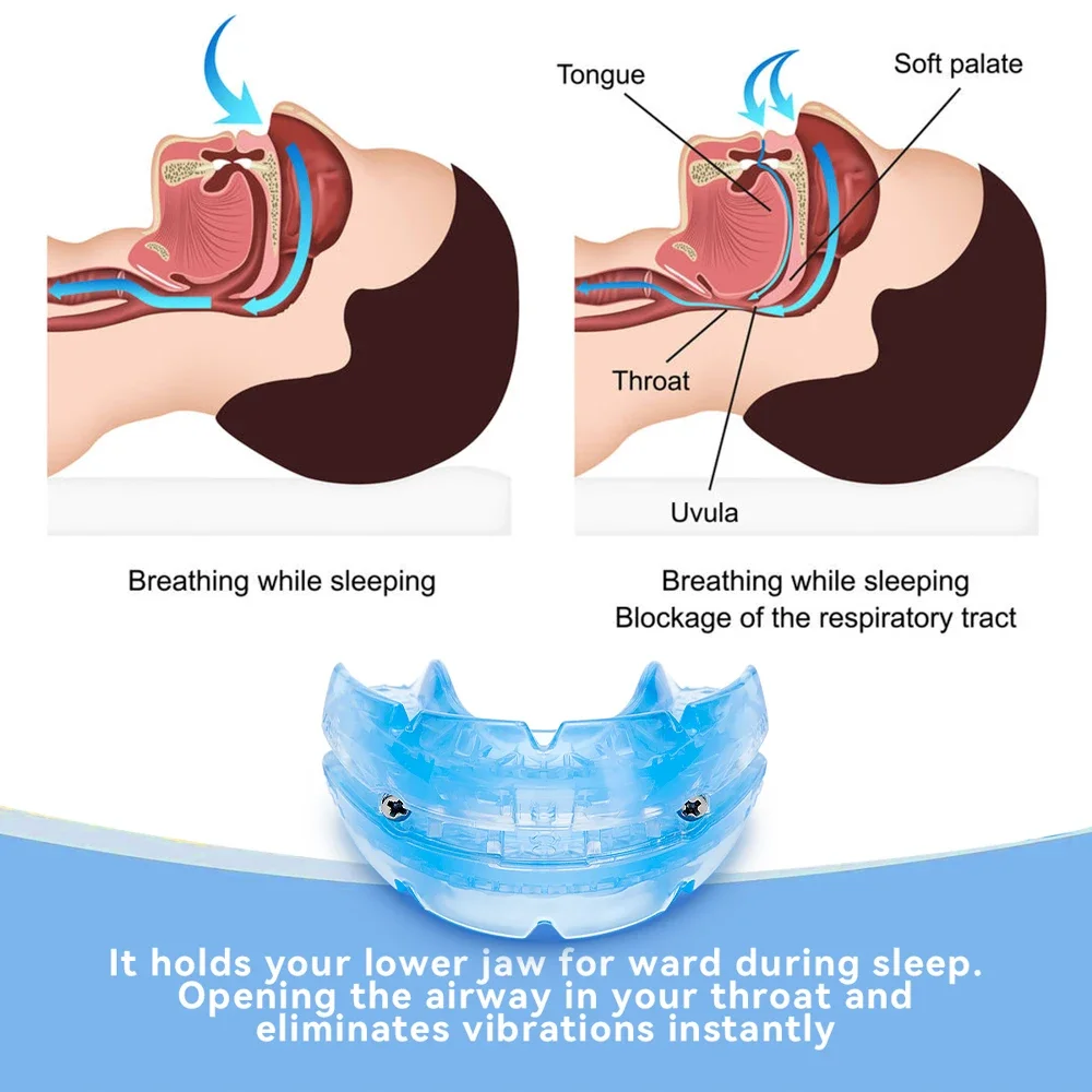 Bruxism Mouth Guard Anti Snoring Improve Sleeping Teeth Bruxism Sleeping Anti Snoring and Apnea Snoring Device To Stop Snoring