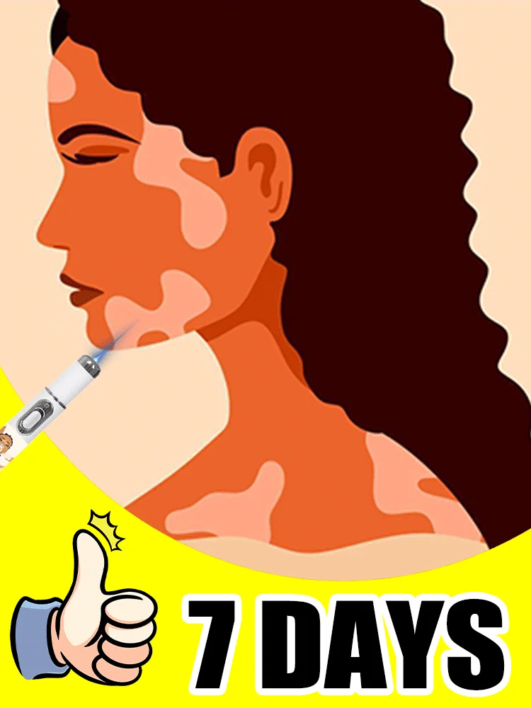 

The new blue light pen can solve Vitiligo