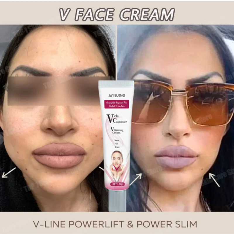 

V Line Face Slimming Cream Artifact Products Double Chin Eliminate Slimming the Face