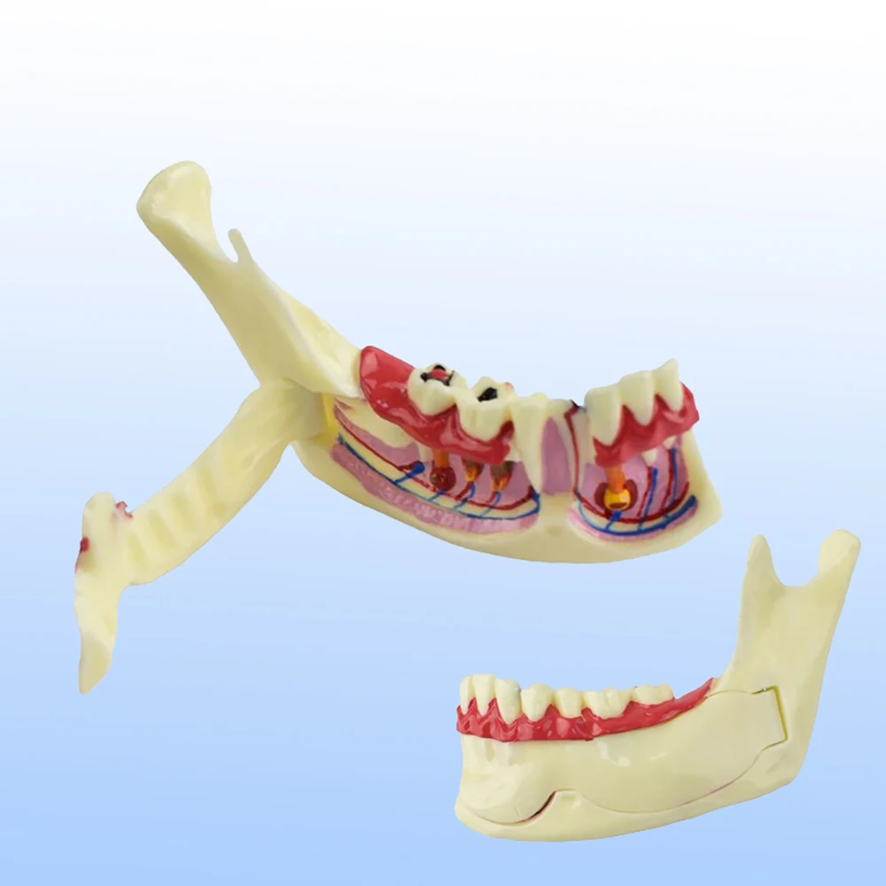 Model leczenia endodontycznego z prawej strony Anatomia dziąseł Materiały dentystyczne Tkanina żuchwy Materiały dentystyczne