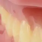 

Новая стоматологическая модель для взрослых, смола, нормальная стоматология, медицинская модель зубов, обучение, образование, оральные стоматологические товары