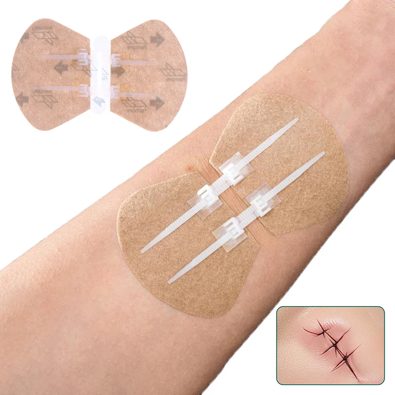 

2 Pcs Zipper Tie Wound Closure Patch Zipper Band-Aid Wound Fast Suture Outdoor Portable Hemostatic Patches First Aid Tool