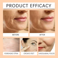 HOYGI Bee Venom Firming Cream Moisturizing Sagging Improvement Reduce Fine Lines Damaged Skin Repair Facial Skin Care Essence 5