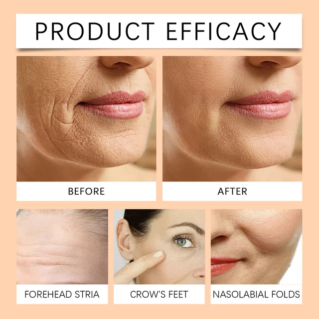 HOYGI Bee Venom Firming Cream Moisturizing Sagging Improvement Reduce Fine Lines Damaged Skin Repair Facial Skin Care Essence 5 HOYGI Bee Venom Firming Cream Moisturizing Sagging Improvement Reduce Fine Lines Damaged Skin Repair Facial Skin Care Essence 5